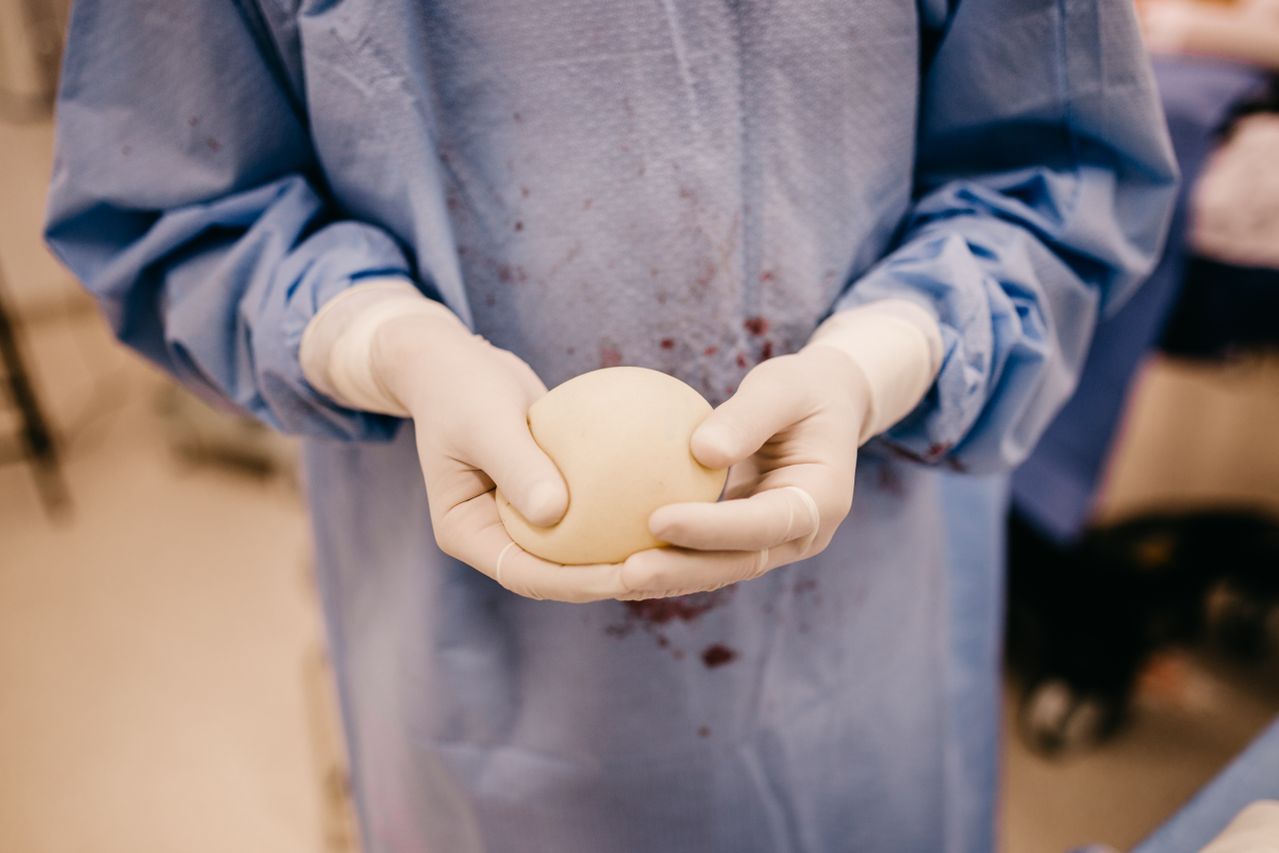 Breast Augmentation with Implants