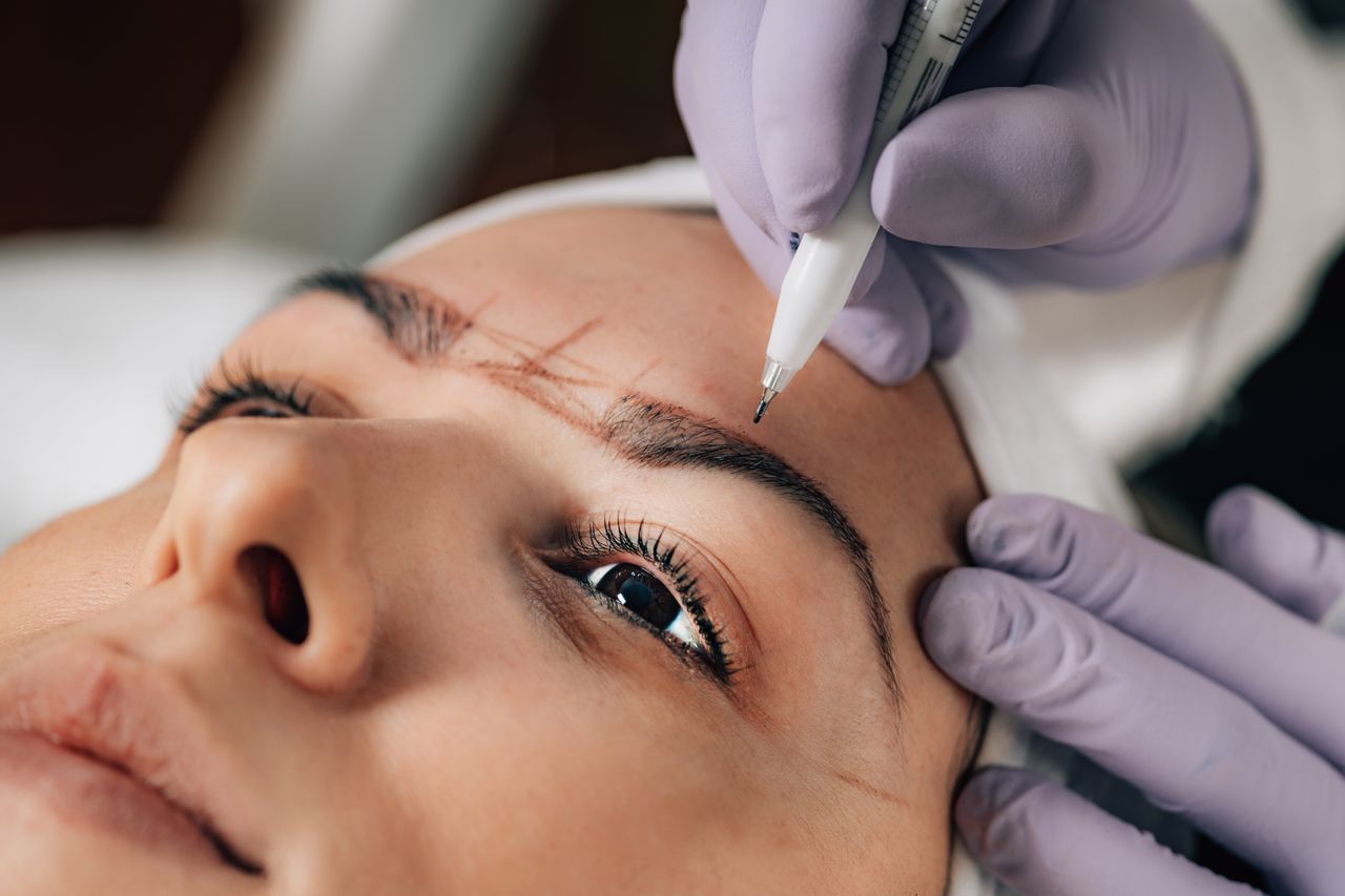 Brow Lift Surgery